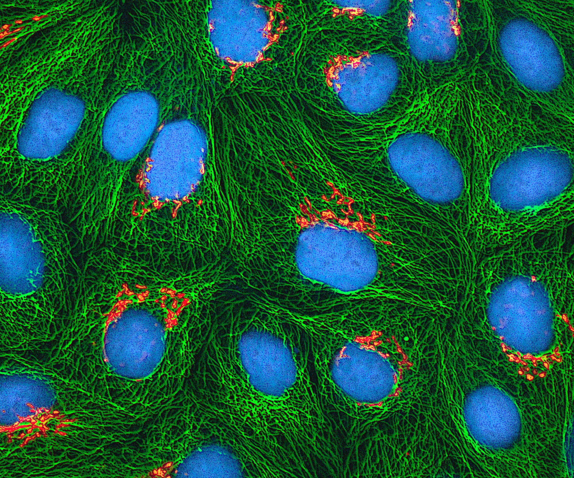 Fluorescence microscopy of HeLa cells, with green microtubules surrounding cyan-stained DNA and orange Golgi structures.